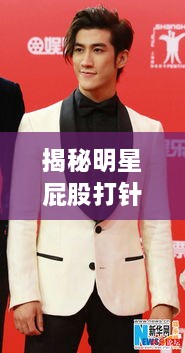揭秘明星屁股打針背后的真相、誤解與公眾關注焦點