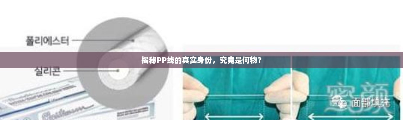 揭秘PP線的真實(shí)身份，究竟是何物？
