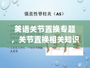 英語關(guān)節(jié)置換專題，關(guān)節(jié)置換相關(guān)知識(shí) 