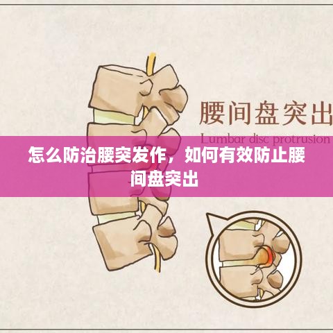 怎么防治腰突發(fā)作，如何有效防止腰間盤(pán)突出 