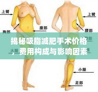 揭秘吸脂減肥手術(shù)價格，費用構(gòu)成與影響因素全解析